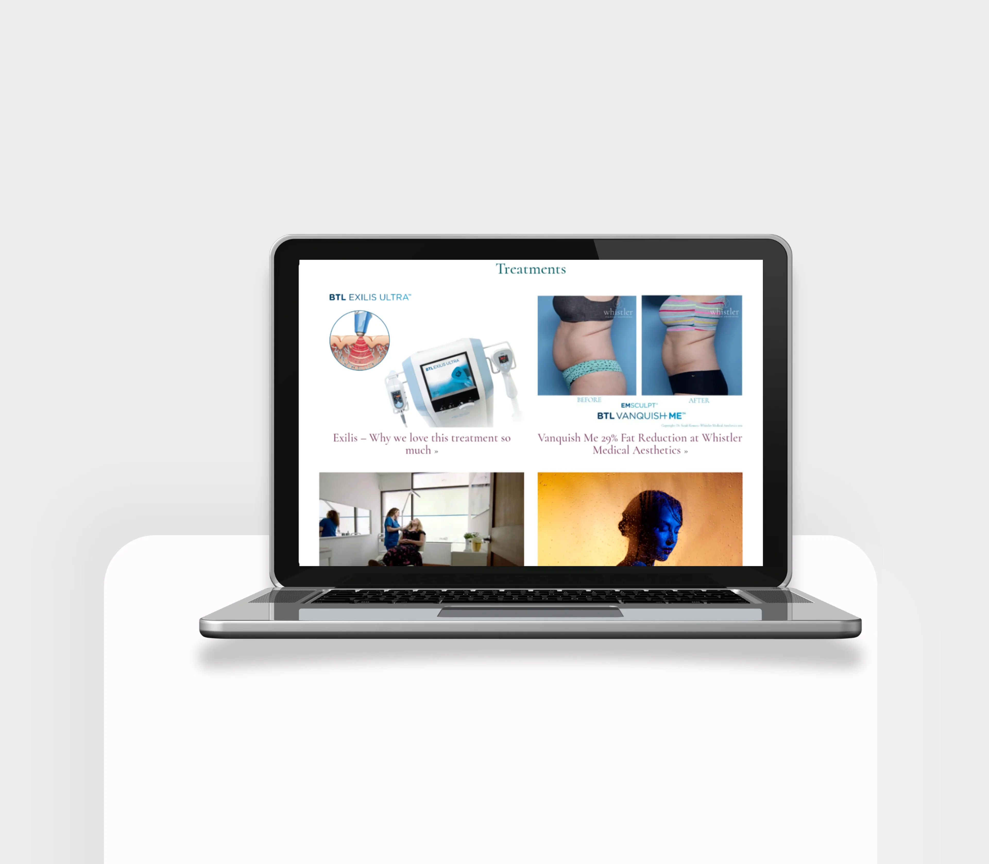 Project Preview